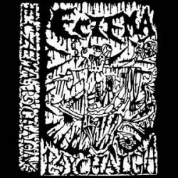 Psychalgia